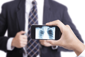 Tele Radiology - Apollo Specialist